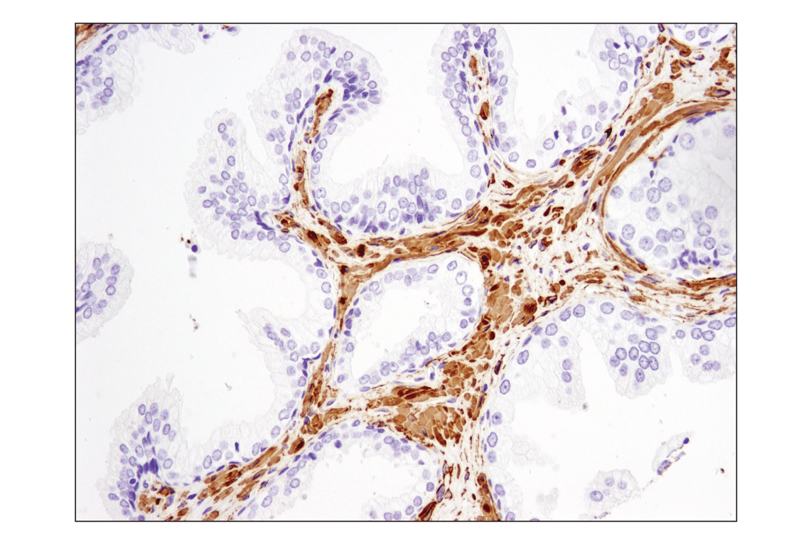 Immunohistochemistry Image 5: alpha-Smooth Muscle Actin (D4K9N) Rabbit Monoclonal Antibody (BSA and Azide Free)