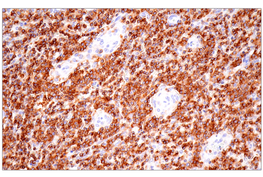 Immunohistochemistry Image 9: SLAMF6/CD352 (E3H1E) Rabbit Monoclonal Antibody (BSA and Azide Free)