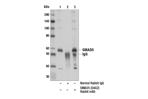 Immunoprecipitation Image 1: SMAD5 (D4G2) Rabbit Monoclonal Antibody