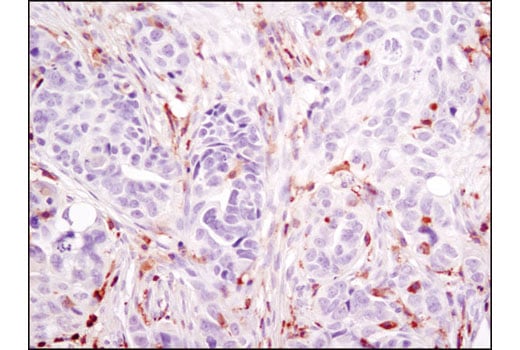 Immunohistochemistry Image 3: LCP1 (D1C3) Rabbit Monoclonal Antibody
