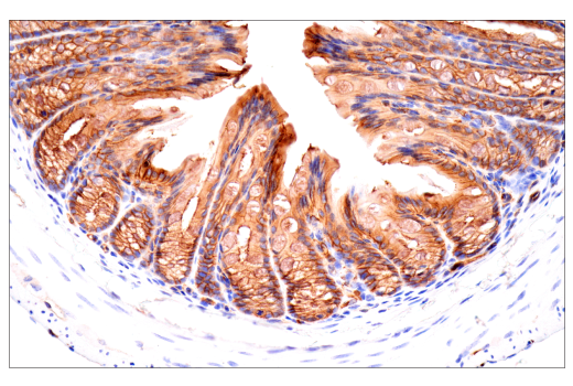 Immunohistochemistry Image 13: CD38 (E9F5A) Rabbit Monoclonal Antibody