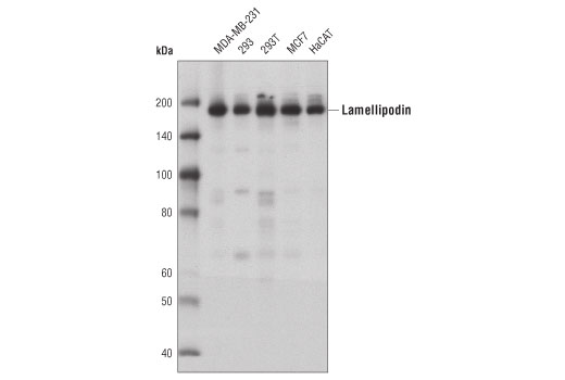 Western Blotting Image 1: Lamellipodin (D8A2K) Rabbit mAb