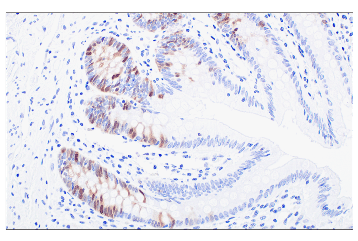 Immunohistochemistry Image 7: PBK/TOPK (F2X2Z) Rabbit Monoclonal Antibody