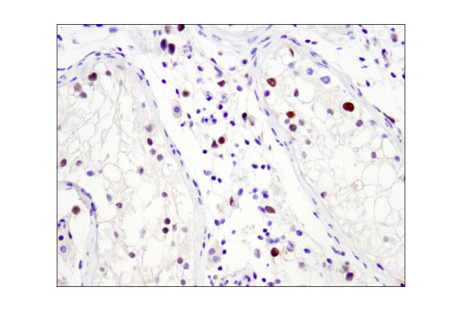 undefined Image 19: Myc Family Profiling Antibody Sampler Kit