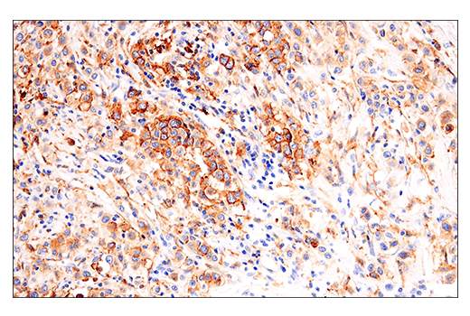 Immunohistochemistry Image 1: HLA-DRA (E9R2Q) XP<sup>®</sup> Rabbit mAb (BSA and Azide Free)