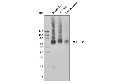 Western Blotting Image 1: VGLUT2 (D4E3U) Rabbit mAb