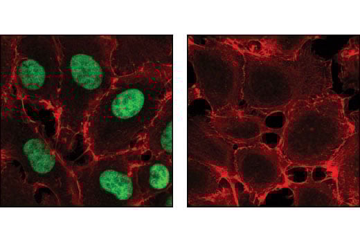 undefined Image 11: Sirtuin Antibody Sampler Kit