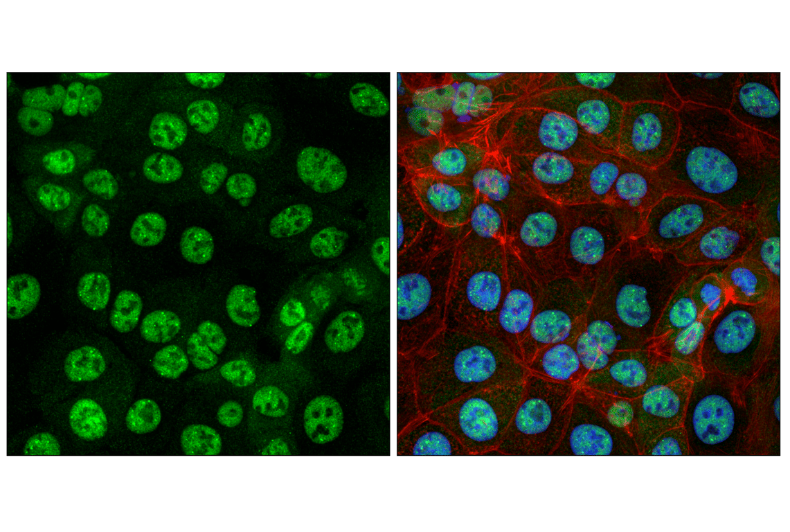 Immunofluorescence Image 1: Rpb1 NTD (D8L4Y) Rabbit Monoclonal Antibody