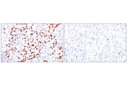 Immunohistochemistry Image 4: Thyroid Transcription Factor 1 (TTF-1) (SPT24) Mouse Monoclonal Antibody