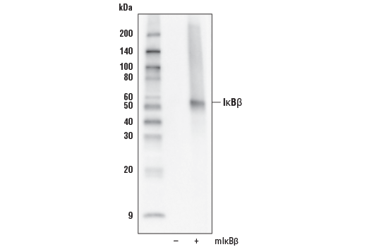 Western Blotting Image 2: IkappaB beta (D2O1T) Rabbit Monoclonal Antibody