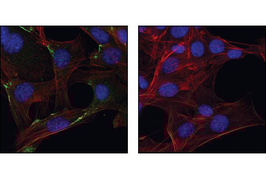 Immunofluorescence Image 1: Profilin-1 Antibody
