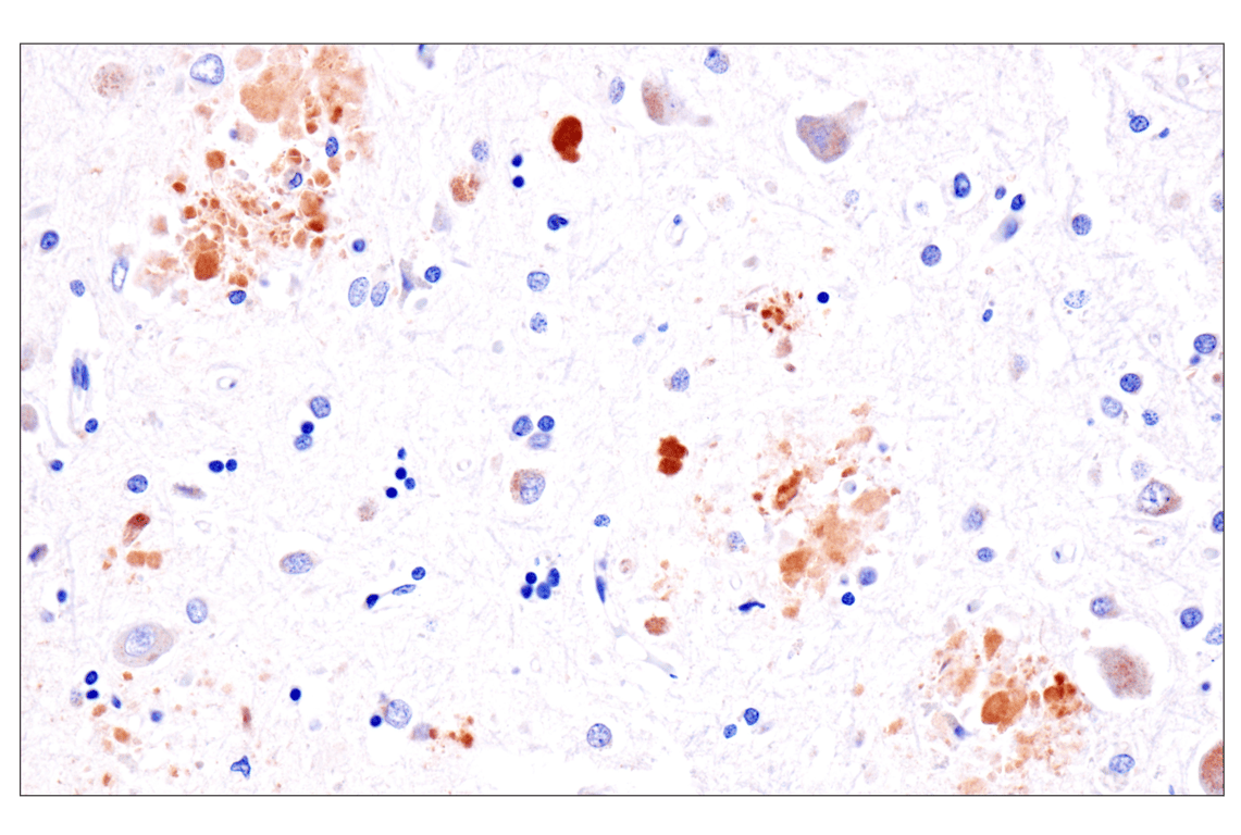 Immunohistochemistry Image 1: Presenilin 2 (F7E5Q) Rabbit Monoclonal Antibody