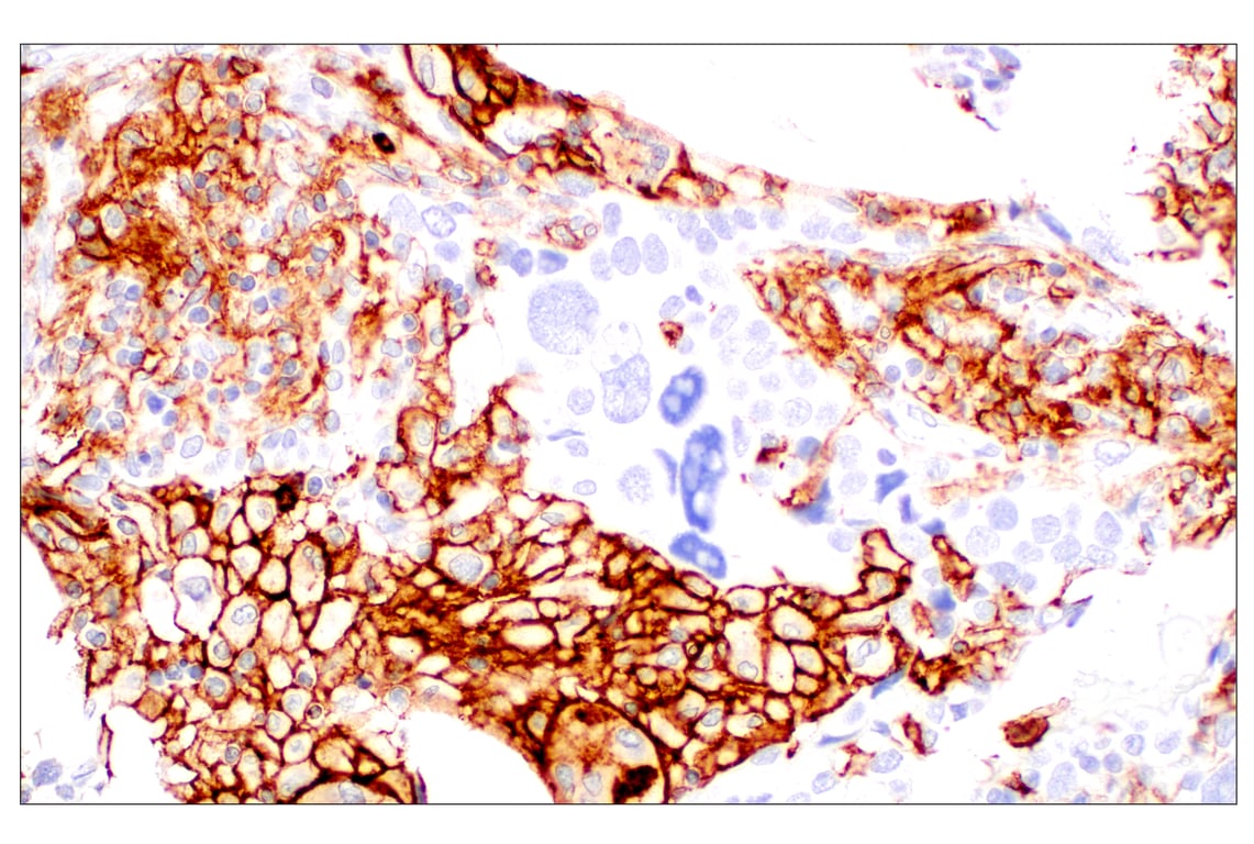 Immunohistochemistry Image 1: CD11b/ITGAM (E3J2F) Rabbit Monoclonal Antibody
