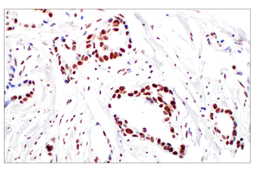 undefined Image 22: ATM Substrates Antibody Sampler Kit