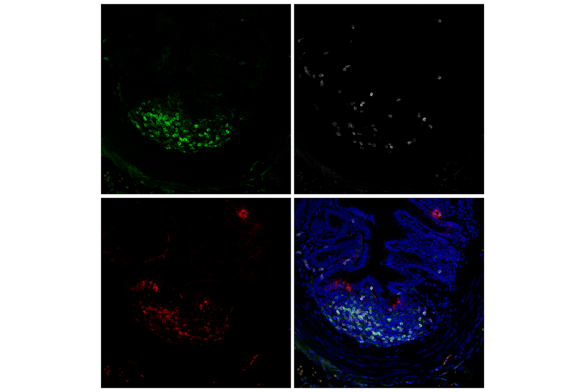 Immunofluorescence Image 1: CD22 (F9D1W) Rabbit Monoclonal Antibody