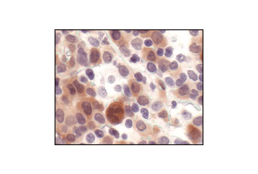 Immunohistochemistry Image 3: Phospho-4E-BP1 (Thr37/46) (236B4) Rabbit Monoclonal Antibody (BSA and Azide Free)