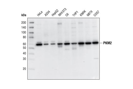 Western Blotting Image 2: PKM2 Antibody