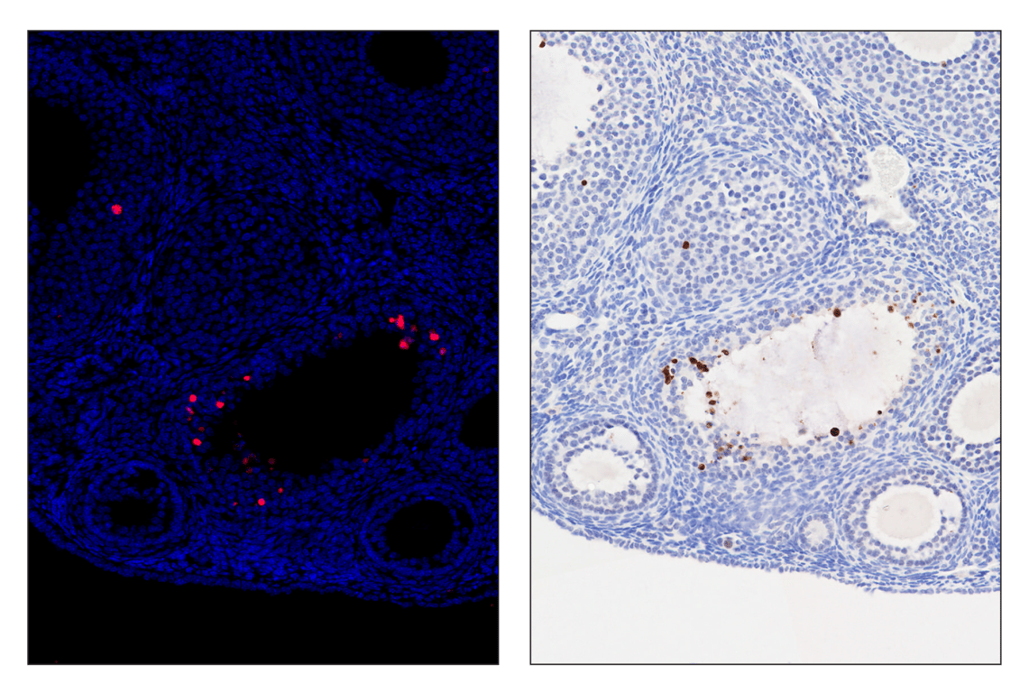 Immunohistochemistry Image 3: Cleaved PARP (Asp214) (D6X6X) & CO-0136-488 SignalStar<sup>™</sup> Oligo-Antibody Pair