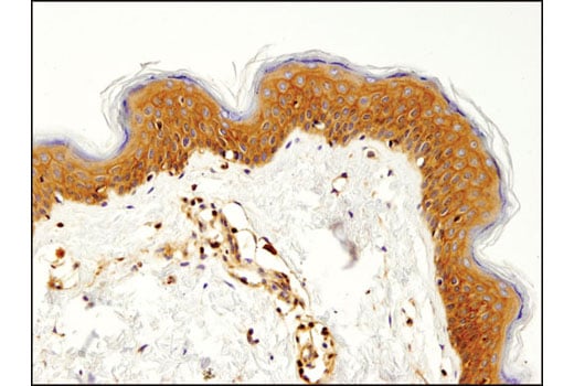 undefined Image 26: MHC Class I Antigen Processing and Presentation Antibody Sampler Kit