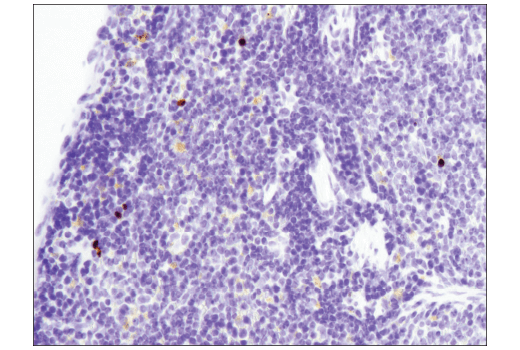 Immunohistochemistry Image 5: Cleaved PARP (Asp214) (D6X6X) Rabbit Monoclonal Antibody