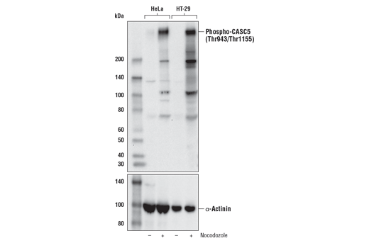 Western Blotting Image 1: Phospho-CASC5 (Thr943/Thr1155) (D8D4N) Rabbit mAb