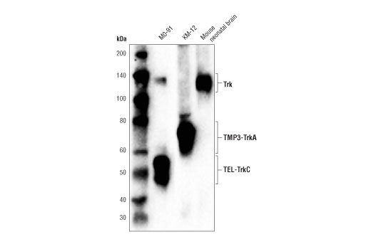 Western Blotting Image 2: Trk (pan) (A7H6R) Rabbit Monoclonal Antibody