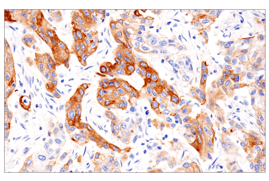 Immunohistochemistry Image 4: Pan-Keratin (Type II) (F6G1P) Rabbit Monoclonal Antibody