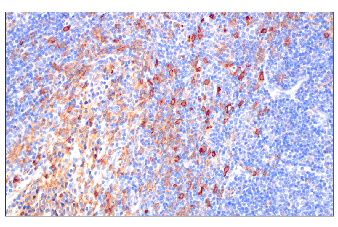 Immunohistochemistry Image 6: DAP12 (F1Q2P) Rabbit Monoclonal Antibody