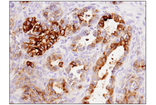 Immunohistochemistry Image 3: Tissue Factor/CD142 (E9M6T) Rabbit Monoclonal Antibody (BSA and Azide Free)