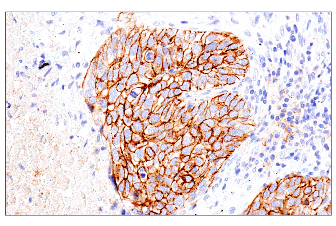 Immunohistochemistry Image 2: Syndecan 1 (E7F7T) Rabbit Monoclonal Antibody (BSA and Azide Free)