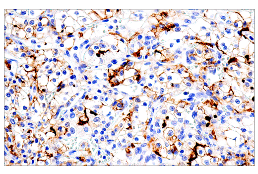 Immunohistochemistry Image 3: ACE2 (E5O6J) Rabbit Monoclonal Antibody (BSA and Azide Free)