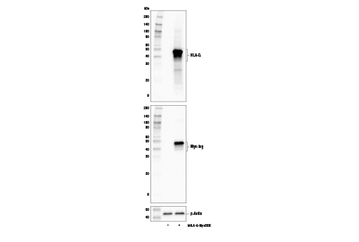 undefined Image 19: MHC Class I Antigen Processing and Presentation Antibody Sampler Kit