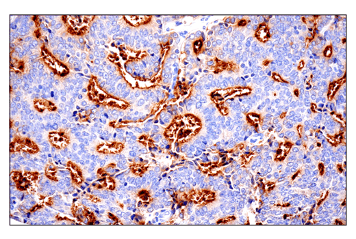 Immunohistochemistry Image 8: CD10/Neprilysin (E5P7S) Rabbit Monoclonal Antibody