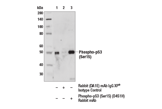 Immunoprecipitation Image 1: Phospho-p53 (Ser15) (D4S1H) Rabbit Monoclonal Antibody