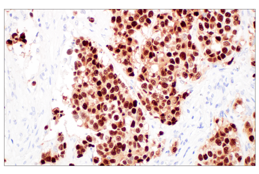 Immunohistochemistry Image 2: POU2F3 (E5N2D) Rabbit Monoclonal Antibody