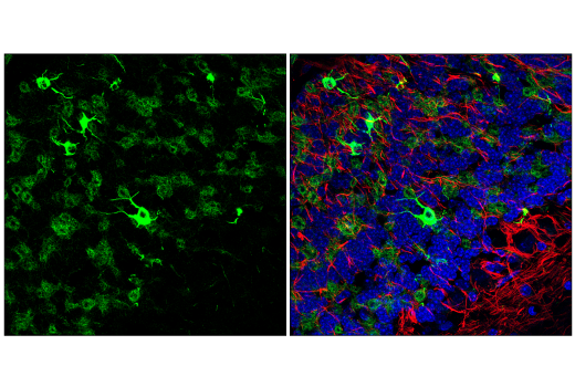 Immunofluorescence Image 1: MAP7 (E8K7O) Rabbit Monoclonal Antibody