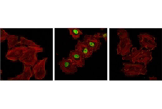 Immunofluorescence Image 1: Phospho-c-Fos (Ser32) (D82C12) Rabbit Monoclonal Antibody (BSA and Azide Free)