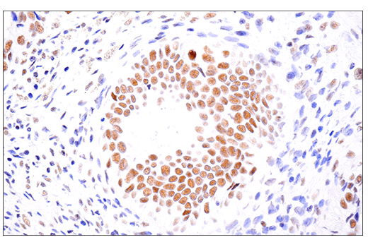 Immunohistochemistry Image 8: SETD2 (E4W8Q) Rabbit Monoclonal Antibody (IHC Formulated)