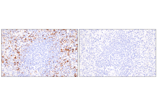 Immunohistochemistry Image 8: CD62P/P-Selectin (E8Q1W) Rabbit Monoclonal Antibody (BSA and Azide Free)