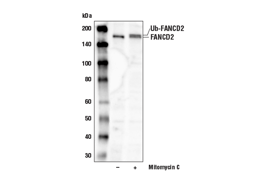Western Blotting Image 2: FANCD2 (D5L5X) Rabbit Monoclonal Antibody