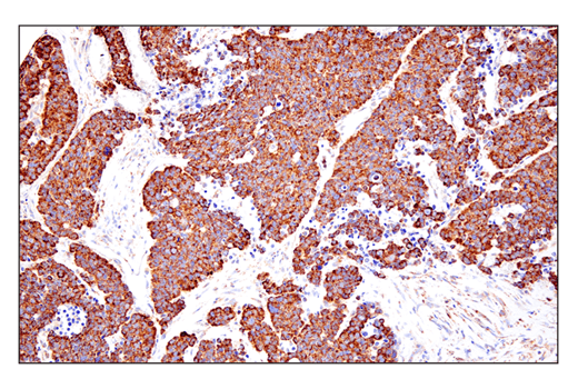 Immunohistochemistry Image 1: SHMT2 (E7F4Q) Rabbit Monoclonal Antibody