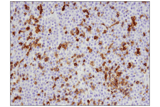 Immunohistochemistry Image 1: CD5 (E8X3S) Rabbit Monoclonal Antibody (BSA and Azide Free)