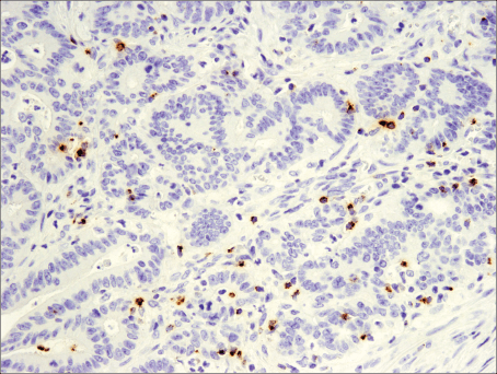 Immunohistochemical analysis of paraffin-embedded human tonsil using CD19 (Intracellular Domain) (D4V4B) XP<sup>®</sup> Rabbit mAb.