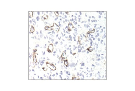 undefined Image 17: Angiogenesis Receptor Tyrosine Kinase Antibody Sampler Kit