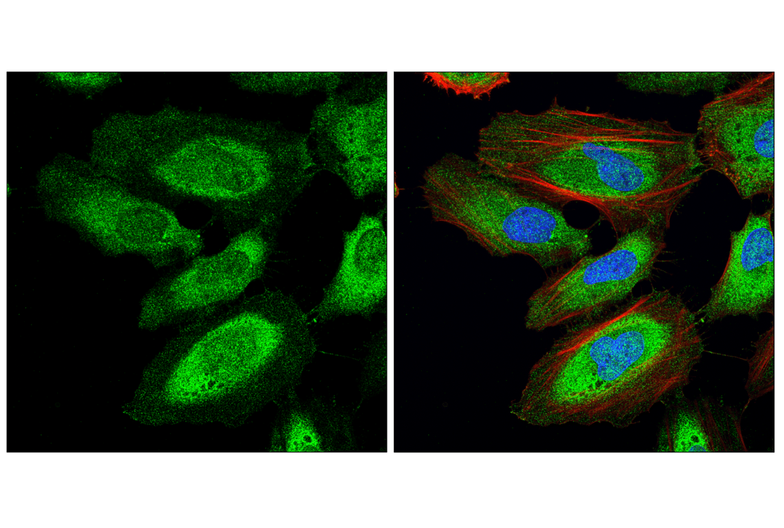 Immunofluorescence Image 1: PP2A C Subunit Antibody
