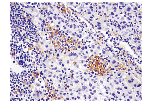 Immunohistochemistry Image 1: PD-L2 (D7U8C) Rabbit Monoclonal Antibody (BSA and Azide Free)
