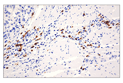 Immunohistochemistry Image 2: CD20 (E7B7T) Rabbit Monoclonal Antibody (BSA and Azide Free)