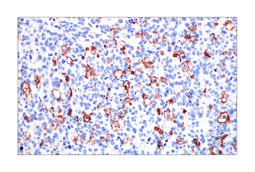 Immunohistochemistry Image 3: Integrin beta2 (E9O7W) Rabbit Monoclonal Antibody (BSA and Azide Free)