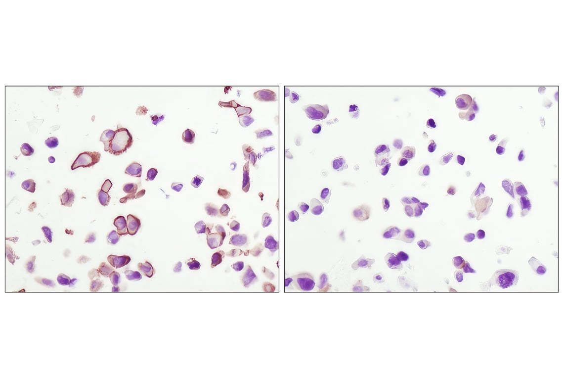 undefined Image 9: PhosphoPlus<sup>®</sup> Akt (Ser473) Antibody Duet