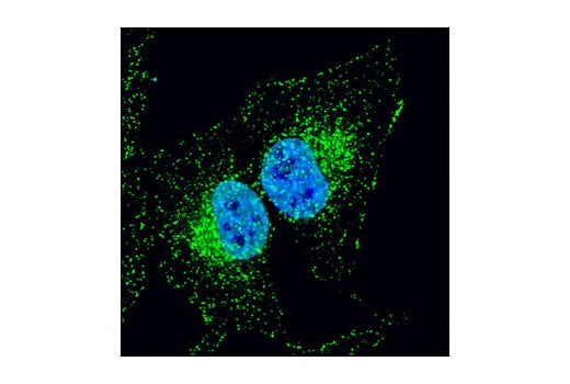 Immunofluorescence Image 1: APPL1 (D83H4) Rabbit Monoclonal Antibody